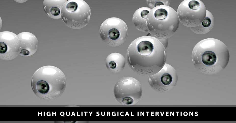 CATARACT SURGERY Slide-4