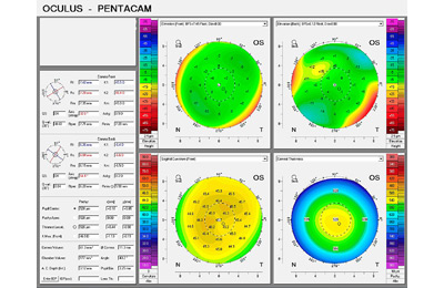 CATARACT SURGERY EYE EXAMINATIONS 08