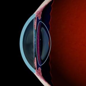 PRESBYOPIA