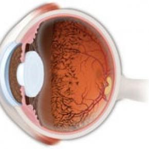 RETINITIS PIGMENTOSA