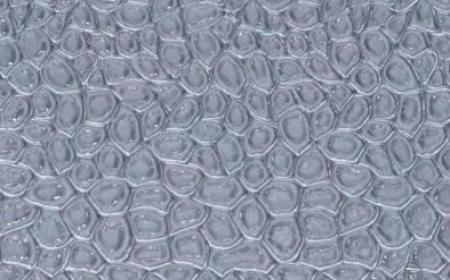 FUCHS DYSTROPHY-1