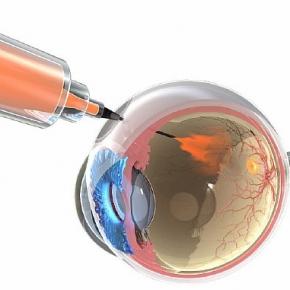 abnormalities or diseases affecting the blood vessels in the retina